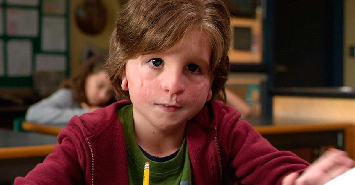 Jacob Tremblay, ator mirim, em "Extraordinário", adaptação cinematográfica do livro de mesmo nome. Jacob interpreta uma criança com síndrome de Treacher Collins, que compromete os ossos da face. Ele está na escola, sentado.