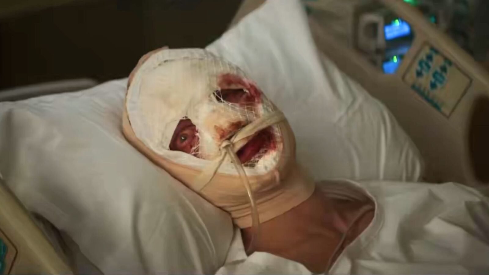 Teaser Cara de barro