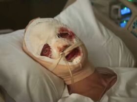 Teaser Cara de barro