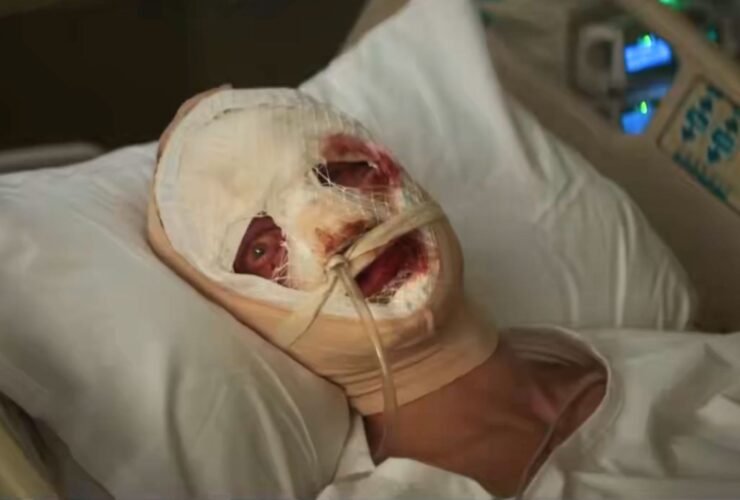 Teaser Cara de barro